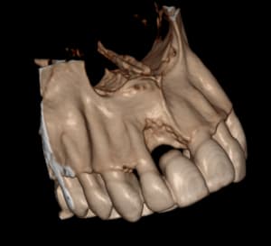 3d qethqx - Eugenol