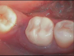 3 h14agw - Eugenol