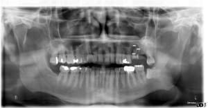 447 x 2011 11 24 16 13 31 4 avutgv - Eugenol