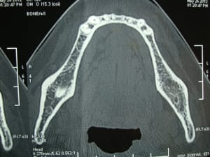 468 fepmvt - Eugenol