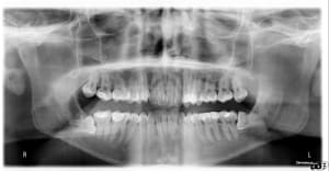 4 ans post nrq8x9 - Eugenol