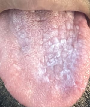 4g9xdmcrbicqaei58i6xscr864aw - Eugenol