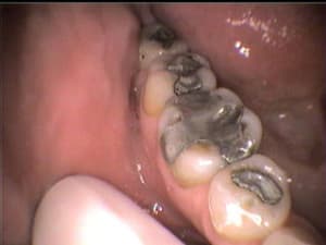 55 ntapgt - Eugenol