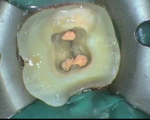 5 lts4w7 - Eugenol