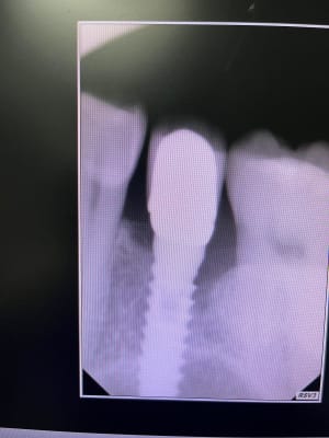 65sv95xm3pmty2lhrae7930z3qdo - Eugenol