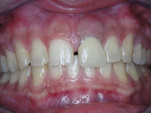 6993 8 jitxxz - Eugenol