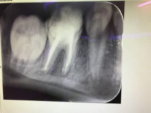 69faeedd cea4 4aa7 8a78 a0b1abf31ff8 rffmg4 - Eugenol