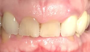 712b04fd 6ae4 41b4 91e7 c6bc615e49b2 py647h - Eugenol