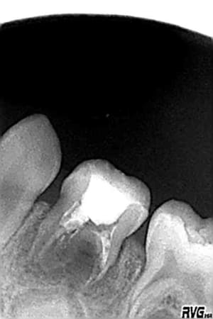 74 2007 dsbhe8 - Eugenol