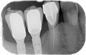 850 x 20180516 112835 xidryewuoud 4 ftocex - Eugenol