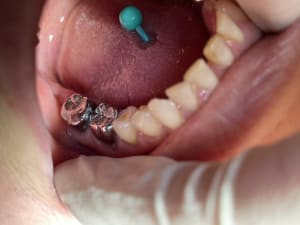 9eb183c1 a341 486e 9520 2e979e8d7070 apxx2h - Eugenol