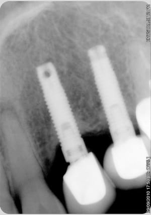 9 ans  xpk9zw - Eugenol