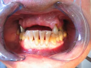 A1 2 rgh12z - Eugenol