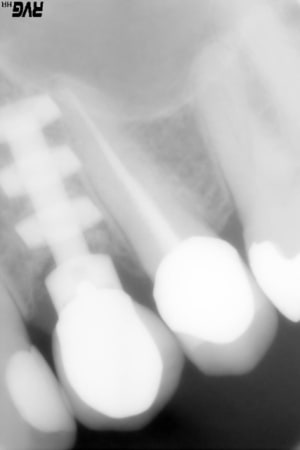 Alexis serge 19 b3riea - Eugenol