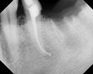 Apr s h3lzxp - Eugenol