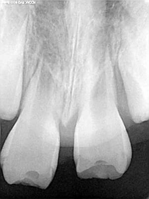 Bb 2005 vsuozk - Eugenol