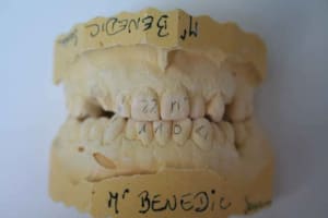 Benedic s1 pfwt7v - Eugenol