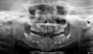 B e 03 02 15 bbzubs - Eugenol