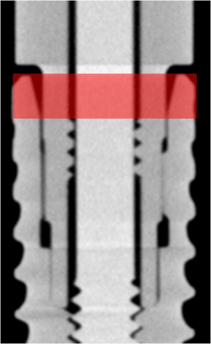 Bone level h4aguy - Eugenol