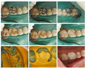 C goulet prep 16  custom  kb8d6s - Eugenol