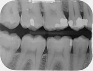 C12 fz4zmx - Eugenol