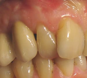Canine sur imp osvgdb - Eugenol