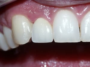 Ccc12avecflash tzqloa - Eugenol