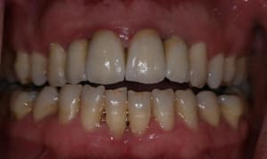 Ccmant2 kkcpjm - Eugenol