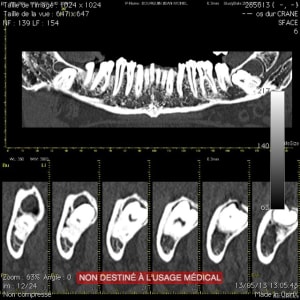 Ct4 ekv8ss - Eugenol