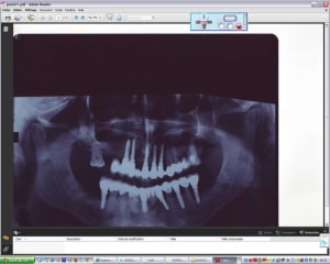 Captpanox1 jrbrlh - Eugenol