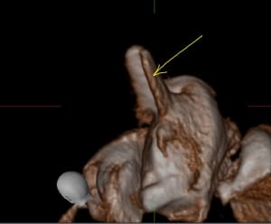 Capture11 yuikfp - Eugenol