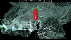 Capture1 bzketg - Eugenol