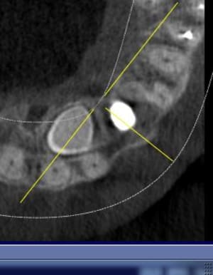 Capture1 hthjjo - Eugenol