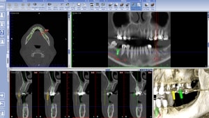 Capture 3 vseo9z - Eugenol