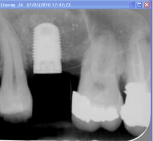 Capture d  cran 2016 04 28   09.52 - Eugenol