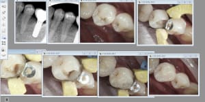 Capture d écran 2017 01 31 07.03 - Eugenol