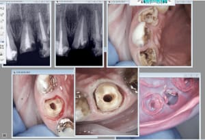 Capture d écran 2017 03 16 17.27 - Eugenol