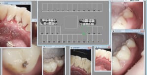 Capture d écran 2017 03 22 18.04 - Eugenol