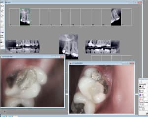 Capture d écran 2017 05 03 09.48 - Eugenol
