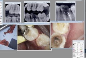 Capture d écran 2018 01 25 12.31 - Eugenol