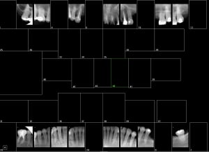 Capture d écran 2018 05 22 16.06 - Eugenol