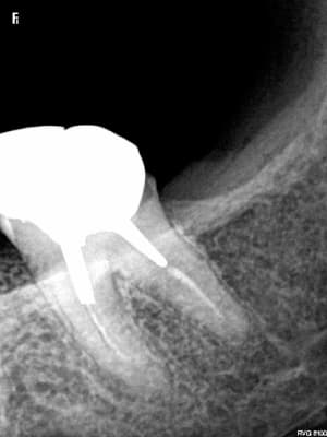 Capture d e cran 2015 05 09 10.42 - Eugenol