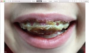 Capture d e cran 2016 01 12 a  13.58 - Eugenol