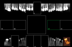 Capture d e cran 2016 04 27 12.31 - Eugenol