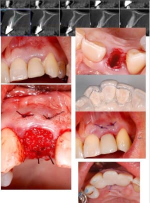 Capture gnvbiw - Eugenol