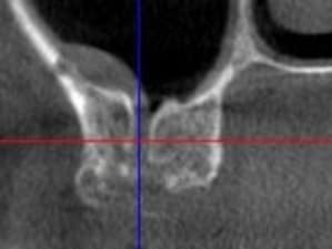 Capture qsaatx - Eugenol