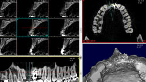 Capture qtyedt - Eugenol