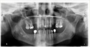 Capture rwfpud - Eugenol