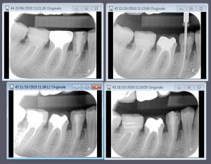 Capture xn6rkn - Eugenol