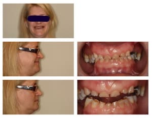 Cas 04 2010  3  2 qeezua - Eugenol